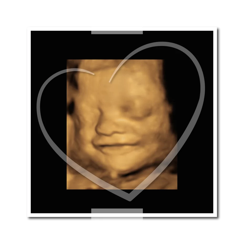 3D 4D Ultrasound Cape Town