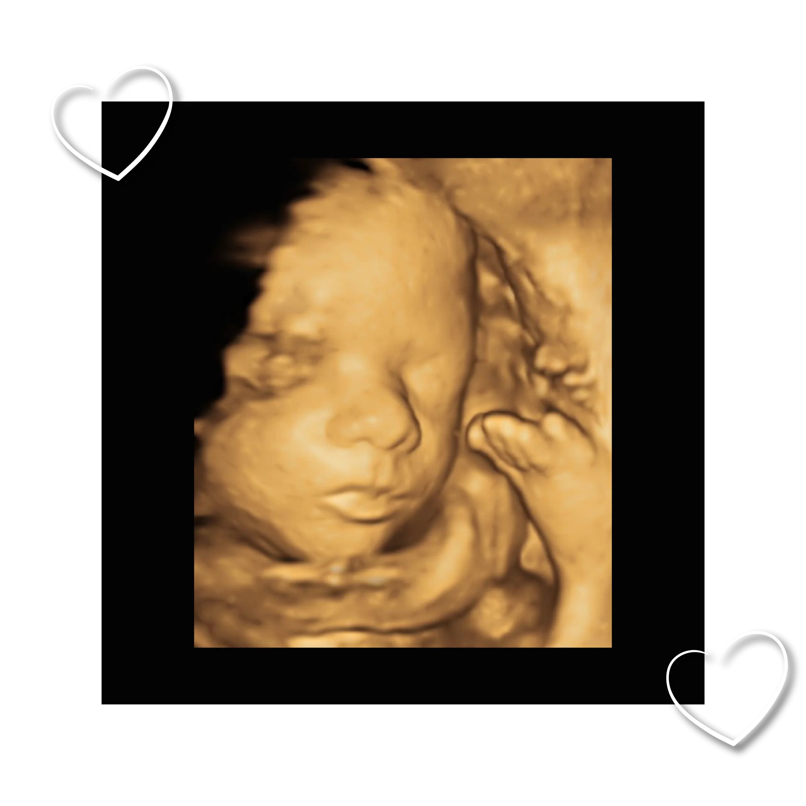 My Little Love Ultrasound Scan