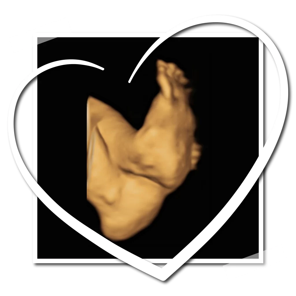 Ultrasound Scan Burgundy Estate, Cape Town