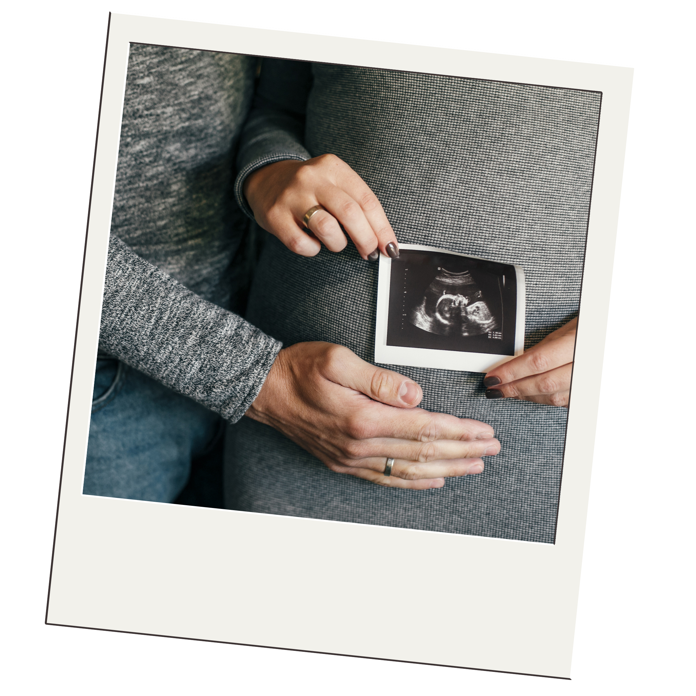 Are 4D Ultrasounds necessary?