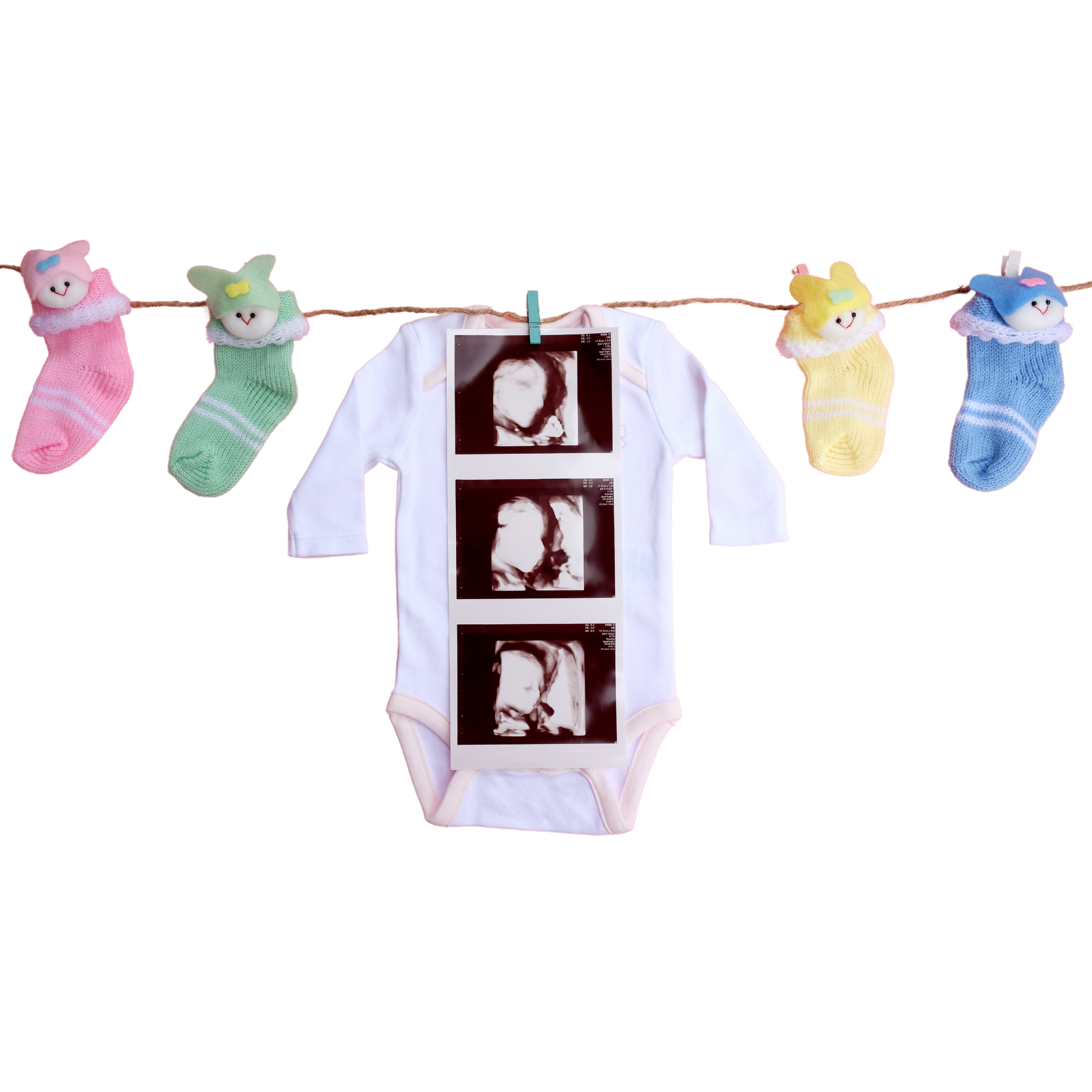 Best time for Ultrasound Scan