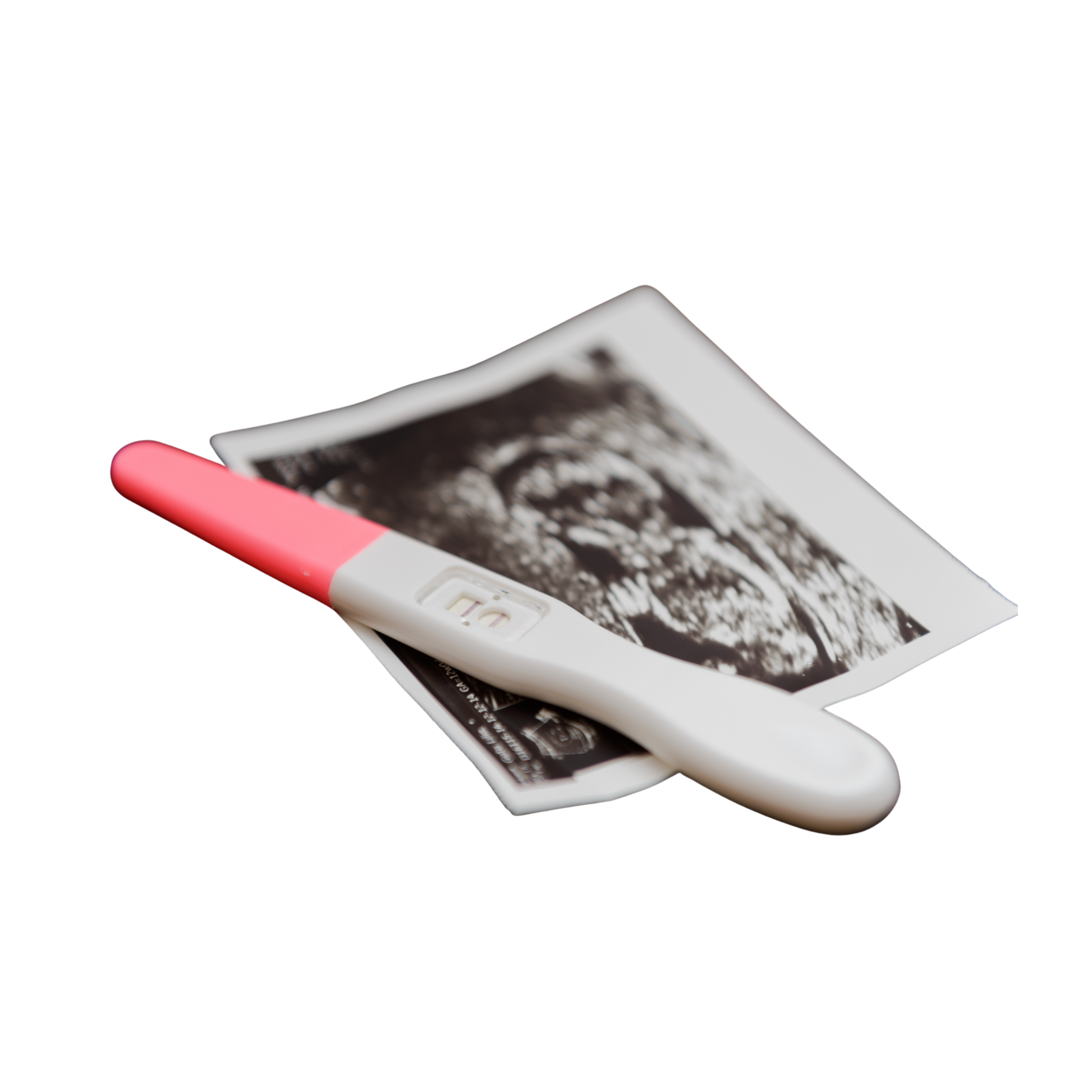 Early Pregnancy and Dating Scan