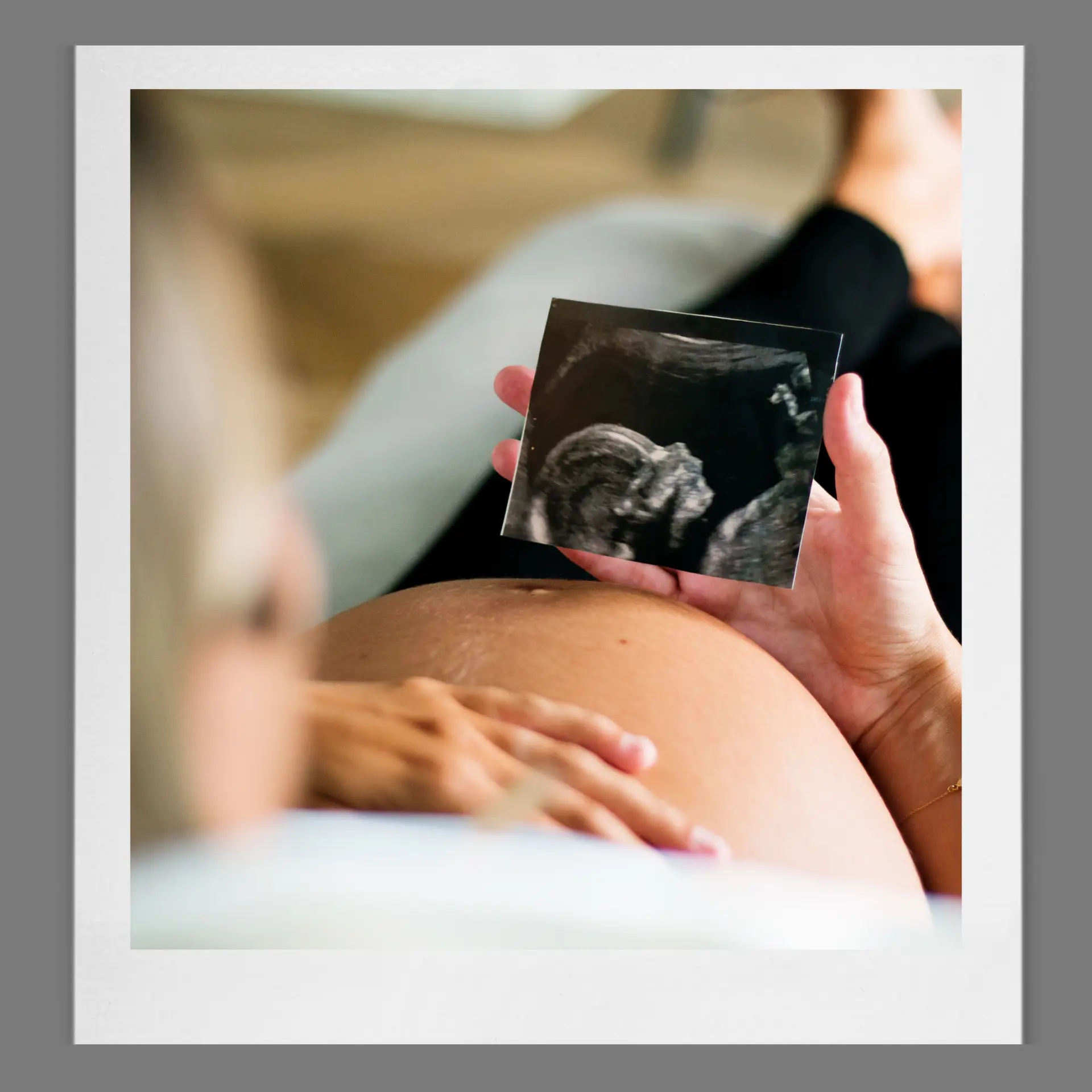 What is a Growth and dopplers scan?