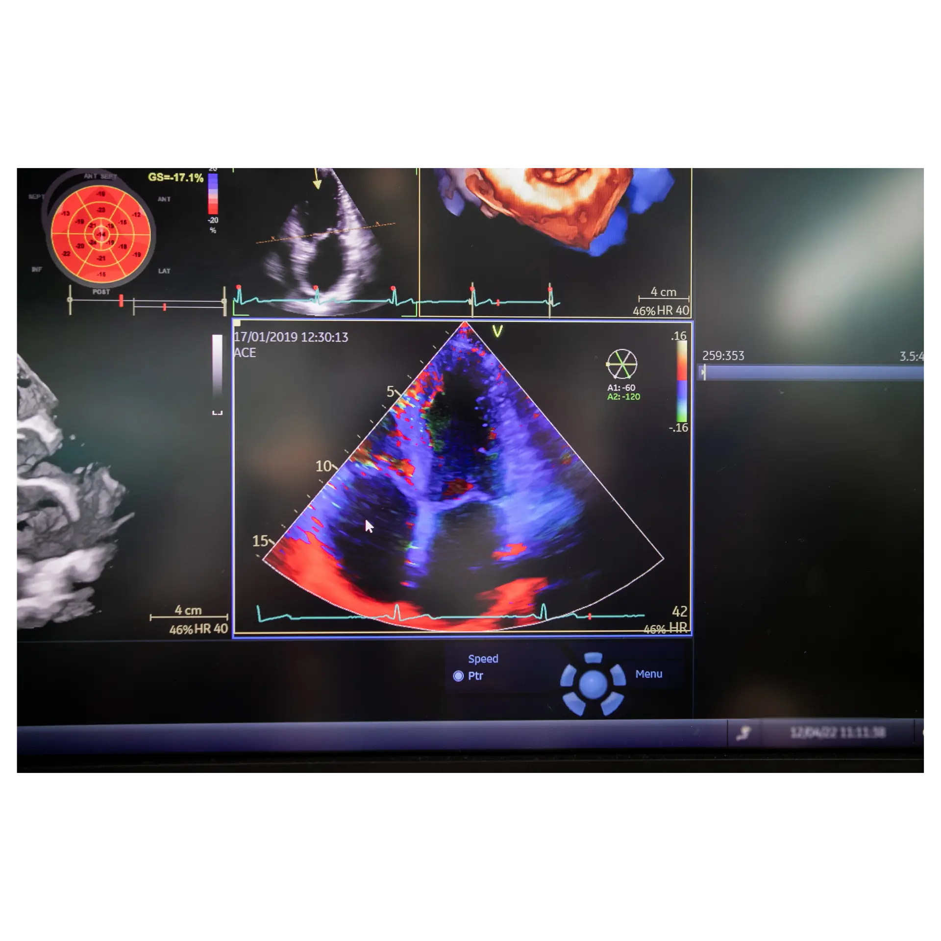 Detail Anomaly scan